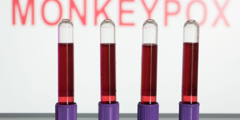 Anvisa autoriza uso emergencial de kits para varíola dos macacos