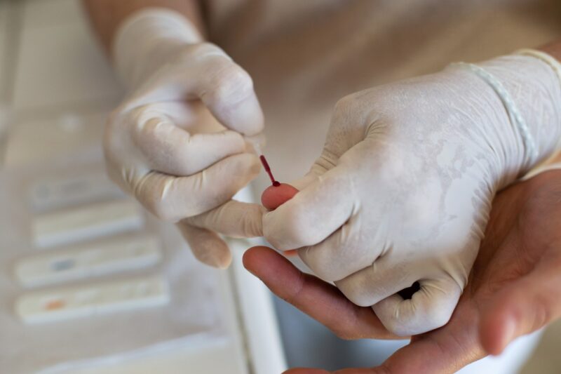 Volta Redonda inicia ações para marcar o Dia Internacional da Luta contra a Aids