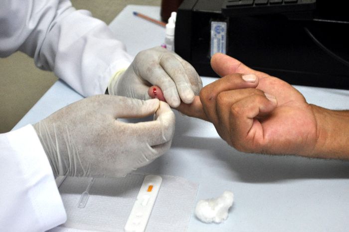 TESTES RÁPIDOS DE HIV, SÍFILIS E HEPATITE B E C SÃO REALIZADOS PELA PREFEITURA DE RESENDE NESTA QUARTA-FEIRA