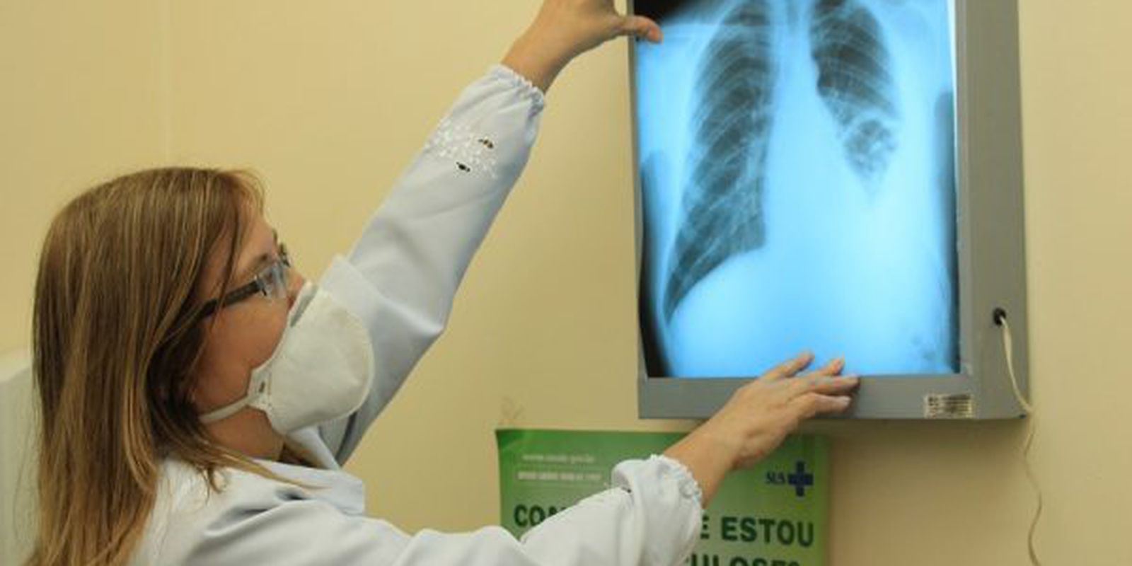 Governo cria comitê para eliminar a tuberculose