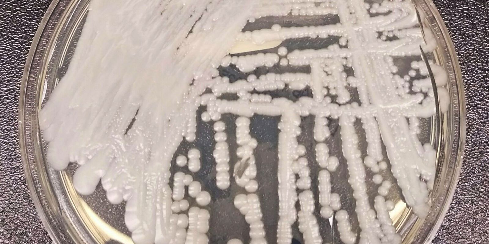 São Paulo confirma primeiro caso de superfungo Candida auris