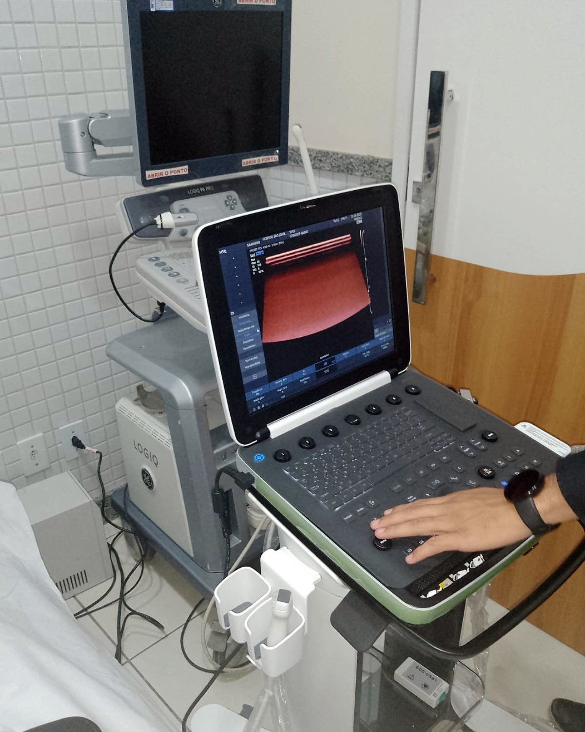 Hospital São João Batista, em Volta Redonda, investe em novo ultrassom para o Centro Cirúrgico