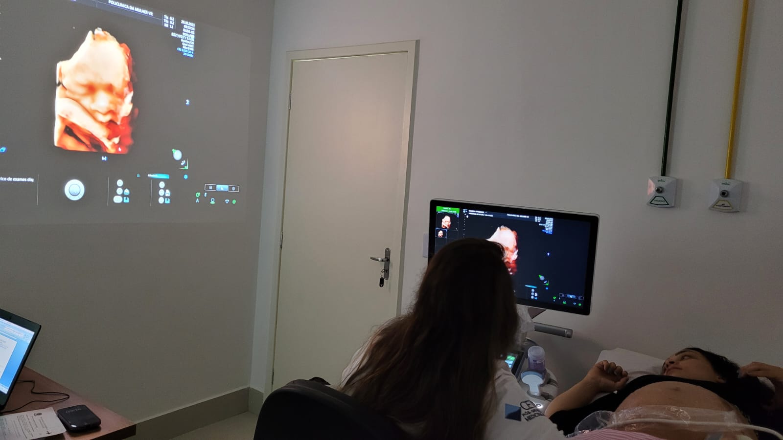Futuras mamães já têm acesso a ultrassom 4D na Policlínica da Mulher de Volta Redonda