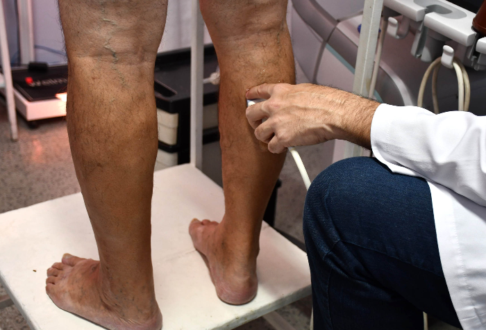 PREFEITURA DE RESENDE PROMOVE MUTIRÃO DE ULTRASSONOGRAFIA VASCULAR NESTE SÁBADO