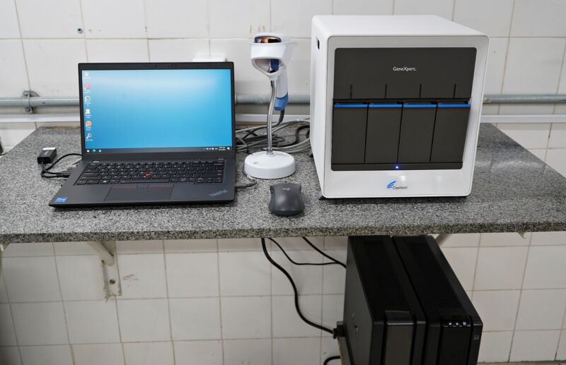 Volta Redonda recebe equipamento que vai agilizar diagnóstico de tuberculose