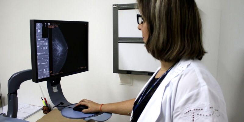 Planos devem estimular mamografias para receber atestado de qualidade