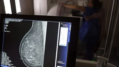 Câncer de mama: uma em cada três pacientes tem menos de 50 anos