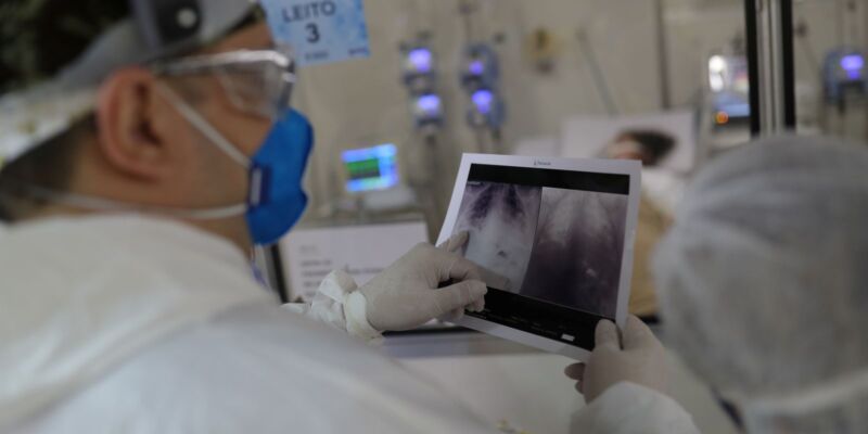 Covid é principal causa de internação por síndrome respiratória no Rio