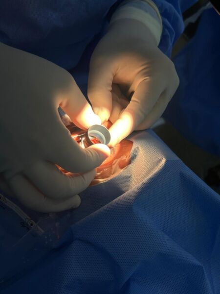 Hospital São João Batista, em Volta Redonda, oferta cirurgia oftalmológica de alta tecnologia