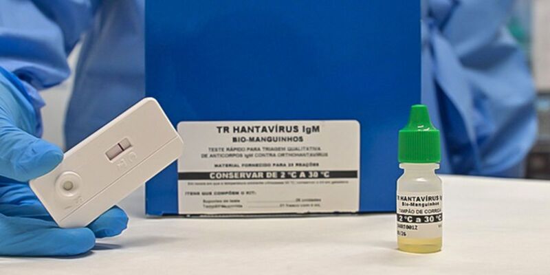Novo teste faz diagnóstico de hantavirose em 20 minutos