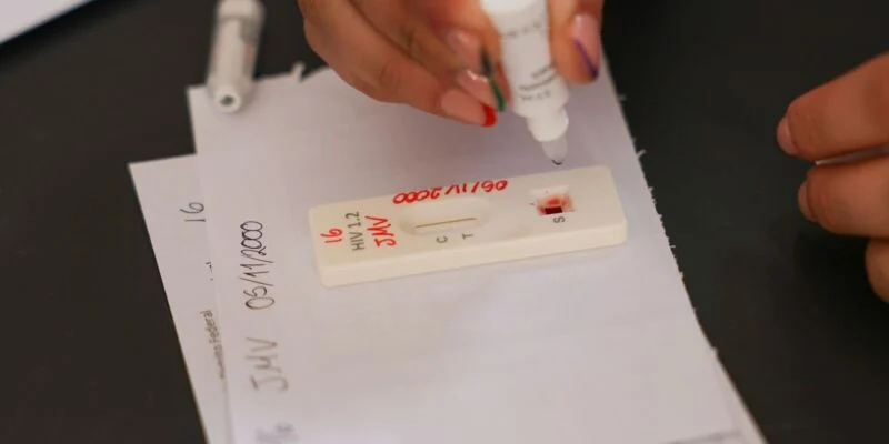 Ação no DF oferece testagem rápida e informação sobre HIV/Aids