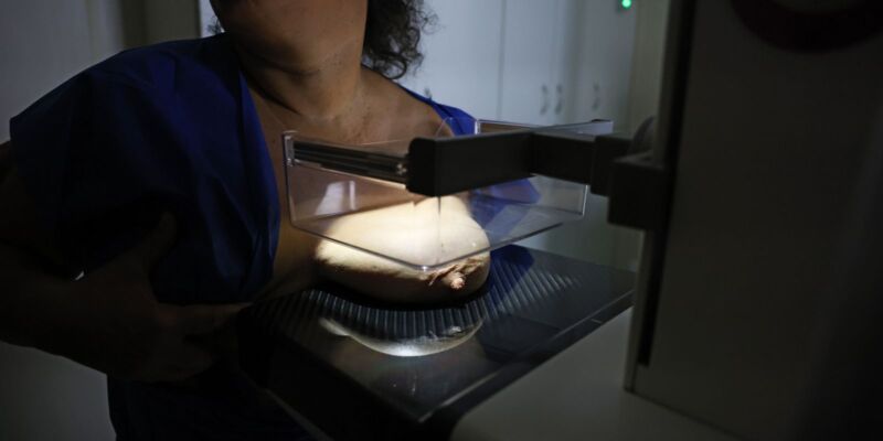 ANS defende que plano cubra mamografia digital sem restrição de idade