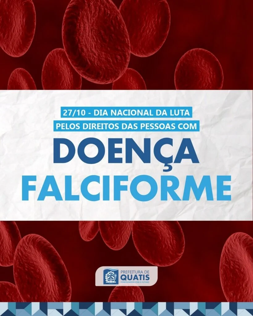 27 de Outubro – Dia Nacional de Luta pelos Direitos das Pessoas com Doença Falciforme